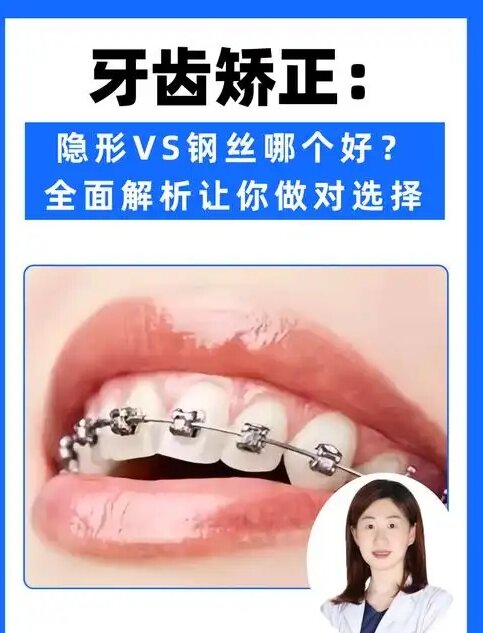 天水隐形矫正哪家好